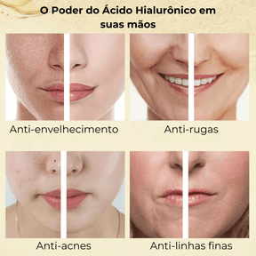 Sérum Facial de Ácido Hialurônico 24k Gold 15ml - Auquest® - Maynner Cosméticos